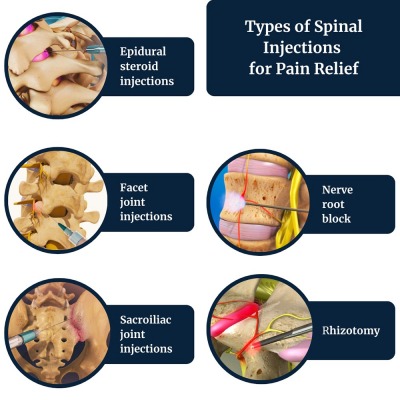 Advantages of Services in Orthopedic Spine Center: Dr. Jamie Gottlieb