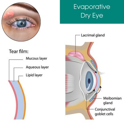 Advantages of Services in Eye Physicians
