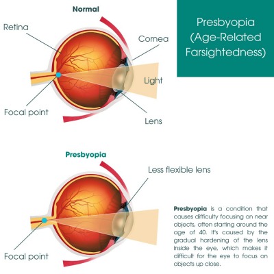 Advantages of Services in Eye Physicians