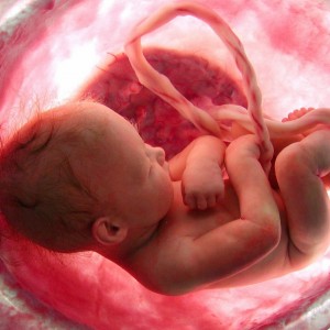 World Congress on Gynecology & Obstetrics