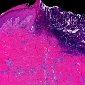 Mayo Clinic Wound Symposium: The Edges of Wound Care 2024