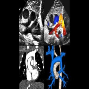 Annual Morphology and Imaging in Congenital Heart Disease: The Key to Diagnosis and Management