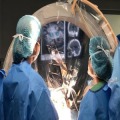 Stereotactic Functional Neuroanatomy Applied to Movement Disorders, Epilepsy, and Pain 2023