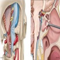Mayo Clinic Open and Endoscopic Techniques to the Cranial Base Surgery Course 2025
