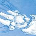 Controversies in Wrist Surgery