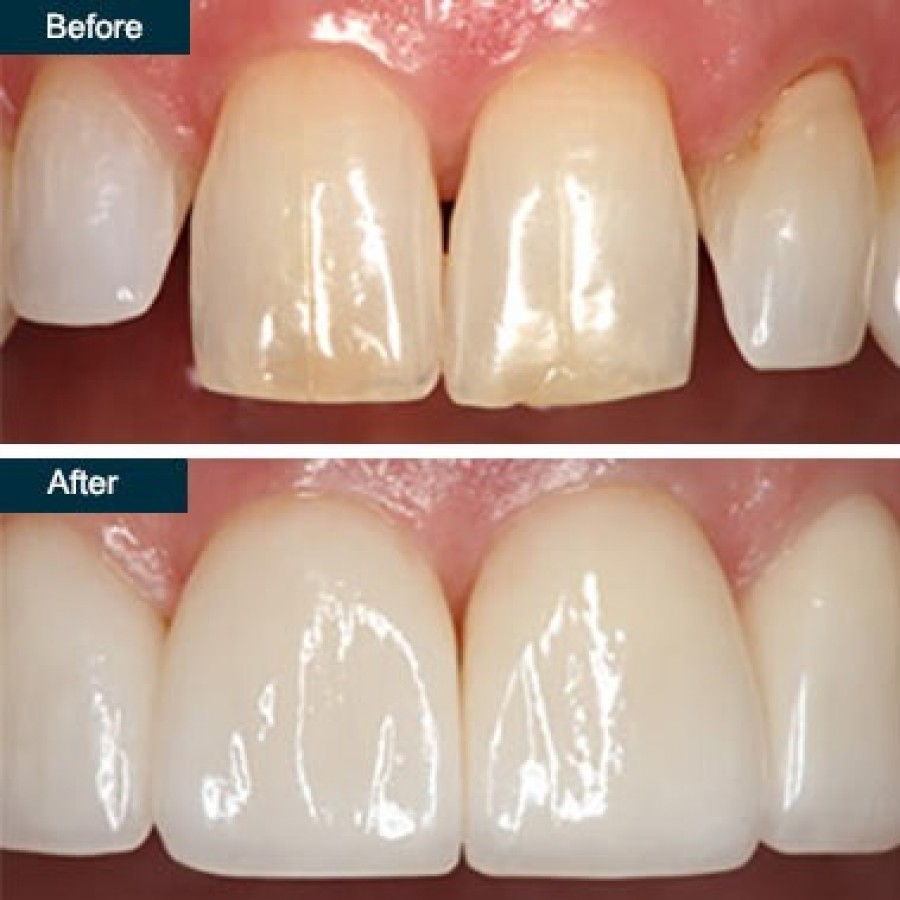 Cosmetic Dentistry In Yonkers, NY