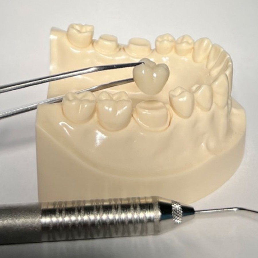 Dental Crowns in Brooklyn, NY