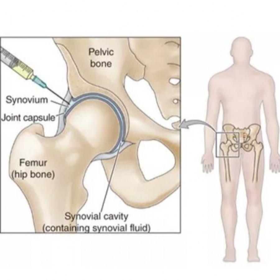 Hip Injury Treatment Specialists in New Jersey