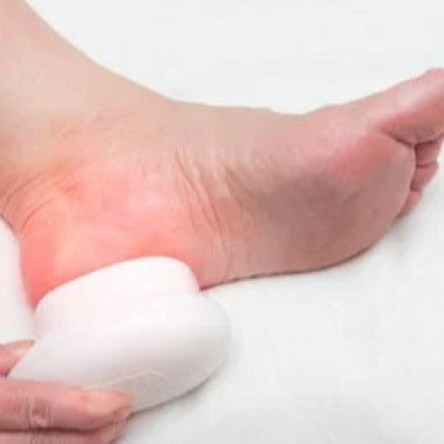 Plantar fasciitis treatment