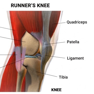 Physical Therapy For Runner’s Knee (PFPS)