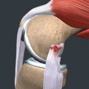 Knee Pain Specialists NJ