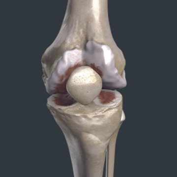Knee Pain Specialists NJ
