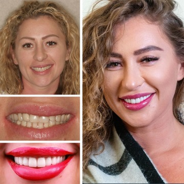 Cosmetic Dentistry