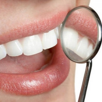 Gum Lift Treatment