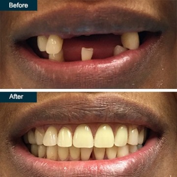 Cosmetic Dentistry In Yonkers, NY