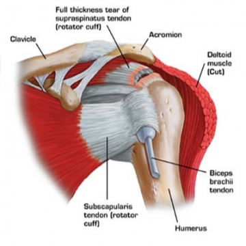 Shoulder Injury Specialists in Midtown Manhattan, NY