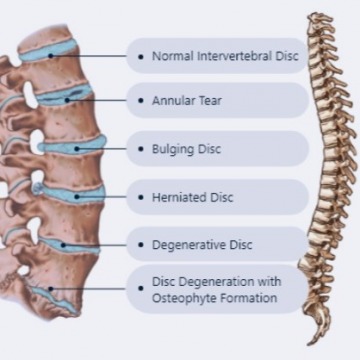 NYC Back Pain Treatment