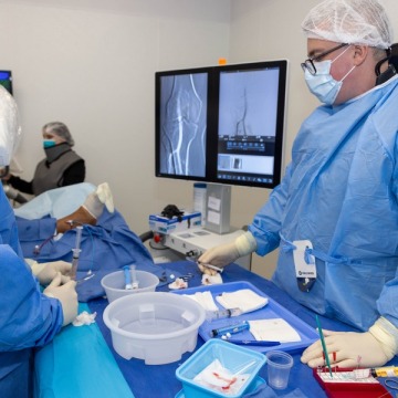 Vein treatment in Brooklyn