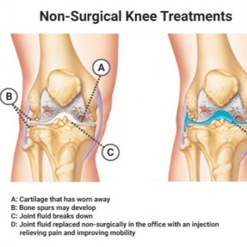 Knee Pain Treatment Specialists NYC