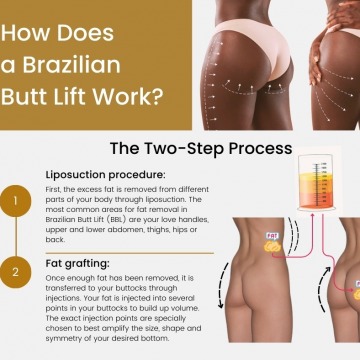 Brazilian Butt Lift Near Me in NYC